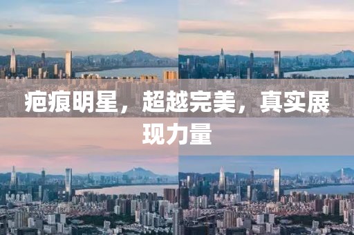 疤痕明星，超越完美，真实展现力量